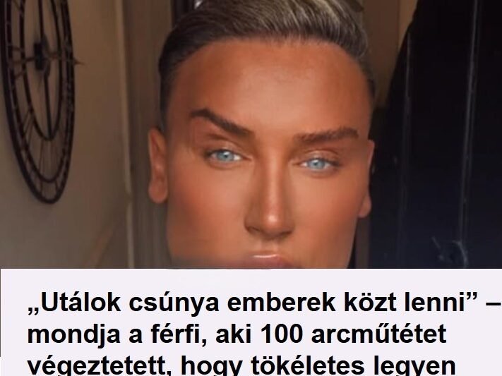 „Utálok csúnya emberek közt lenni” – a férfi, aki 100 arcműtétet vállalt a tökéletességért