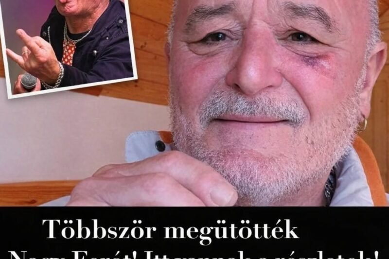 „Sokkoló részletek! Nagy Ferót többször bántalmazták – a történet részletei a hozzászólásoknál”